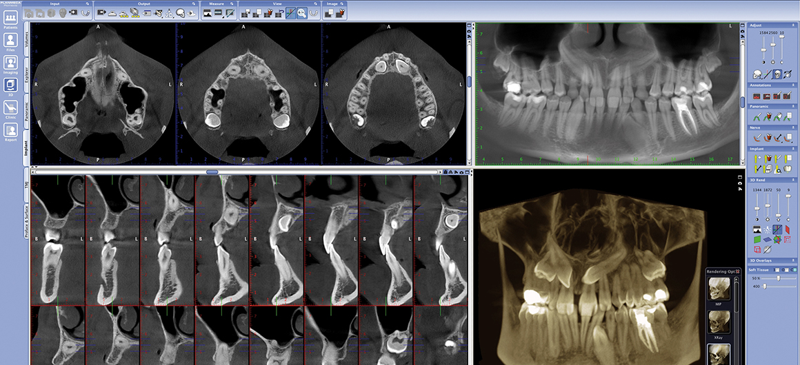 Radiologia_digital