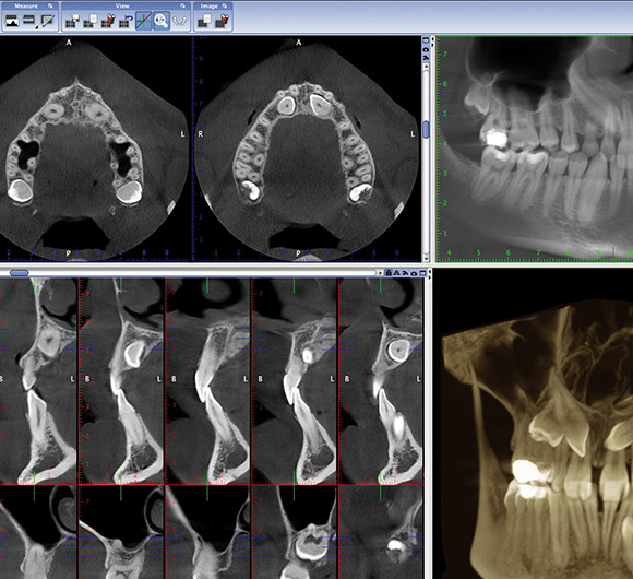 Radiologia i TAC 3D Digital