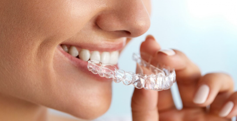 Ortodoncia invisible, ¿qué es?